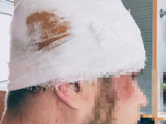 Житель Апрелевки в больнице после конфликта с иностранцами